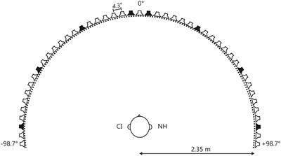 Sound Localization in Single-Sided Deaf Participants Provided With a Cochlear Implant